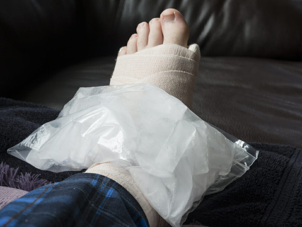 Treatment options for sprained ankle